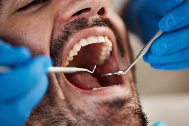 Best Orthodontic Emergency Dentist in North Kingsville, OH